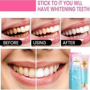 Niacinamide Whitening Toothpaste – Black and solid
