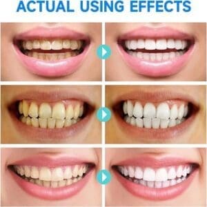 Niacinamide Whitening Toothpaste – Black and solid